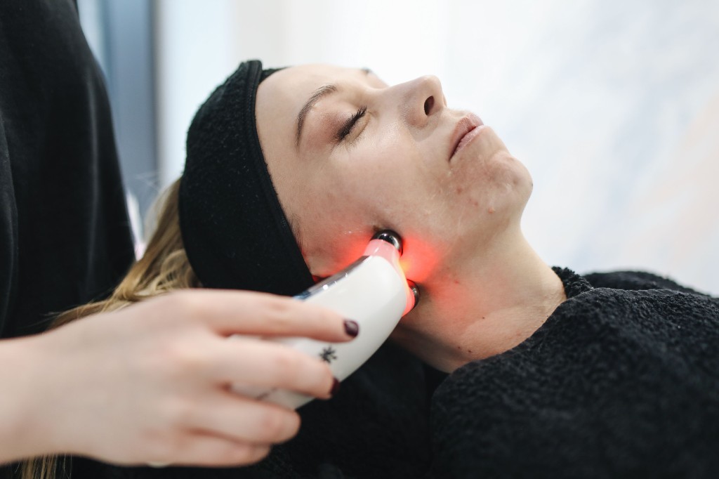 Understanding Acne Scars and Modern Treatment Options